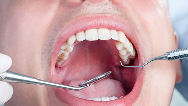 膜龈手术有风险吗 膜龈手术会损害牙齿吗