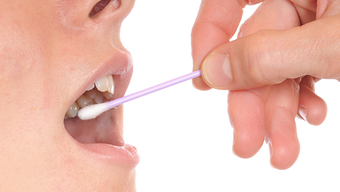 缺少维生素会导致嘴唇干裂吗 日常护理的5个方法你学会了吗