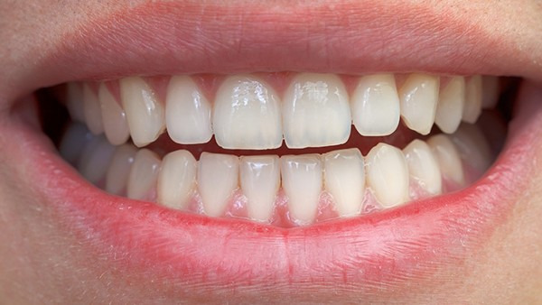 牙齿出血是什么原因导致的 多半是这两种病因引起的