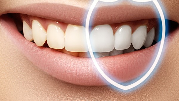牙龈炎的症状都有哪些 牙龈炎的治疗方法都有哪些