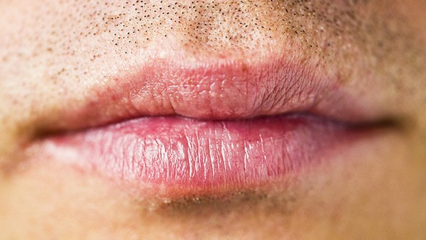 唇炎的症状和类型有哪些，唇炎的常见类型有3个