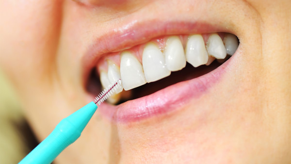 牙龈瘘管是什么 牙龈瘘管该如何治疗