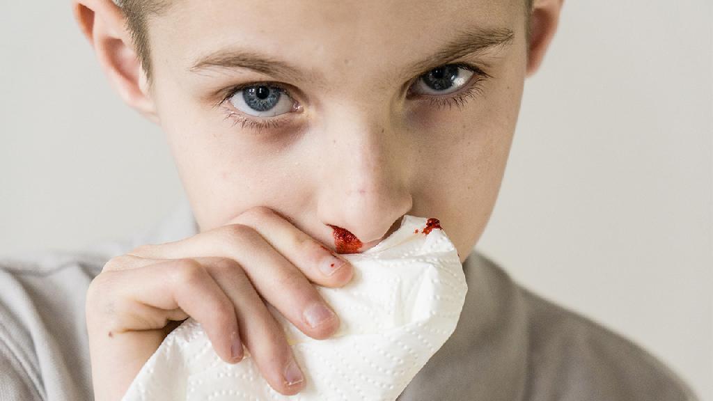 流鼻血的常见病因都有哪些 流鼻血需要重视吗