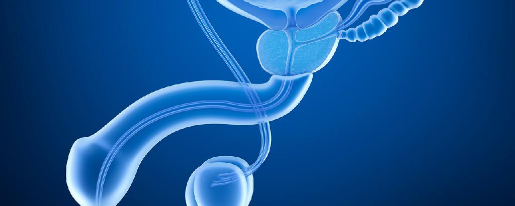 前列腺强回声斑是什么，如何预防前列腺疾病？