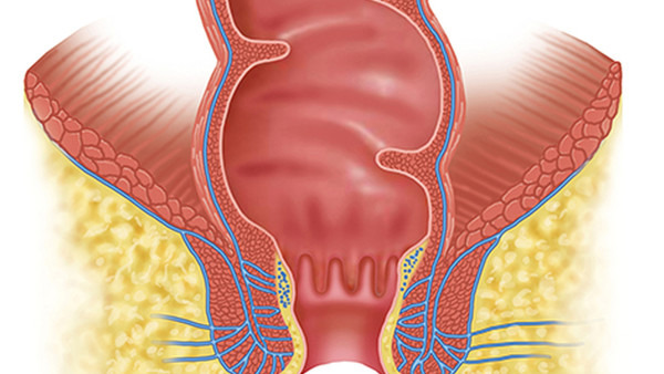 宫颈糜烂的症状，宫颈糜烂患者最常见的4个症状