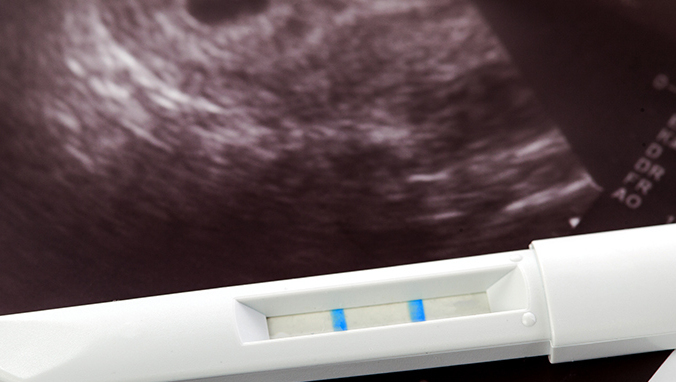 有宫外孕史如何备孕？做全面身体检查