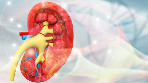 血透和腹透有什么区别 透析的3大副作用