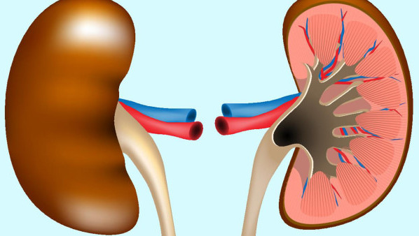 腎囊腫是怎么引起的 單純性腎囊腫一般不需進(jìn)行治療嗎