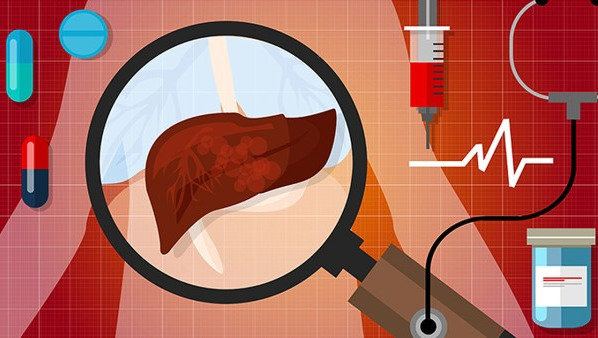 转氨酶多少是正常 转氨酶升高饮食禁忌事项有3点