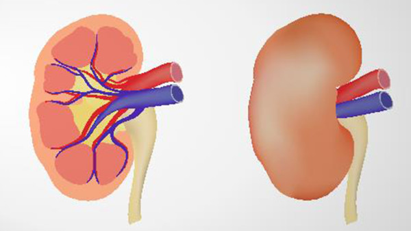 什么是腎后性腎衰？一種腎功能衰竭