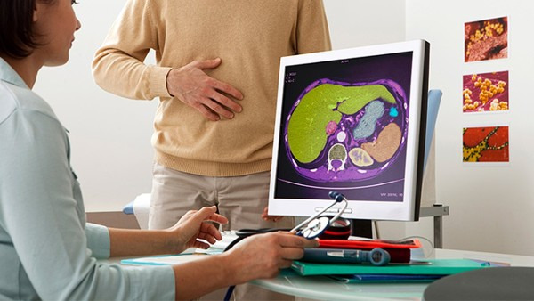 怎么判断自己是否得了脂肪肝 脂肪肝一定要做CT检查吗