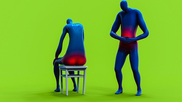 坐骨神经痛怎么根治