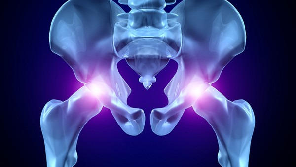 髋关节炎的病因