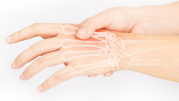 骨折后怎样恢复得快