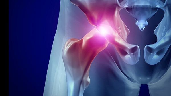 老年髋部骨折是怎么回事