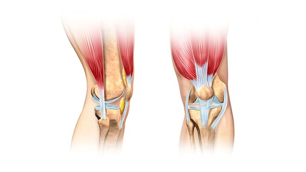 膝关节游离体怎么形成的 导致膝关节游离体的病因