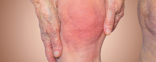 膝盖疼痛该怎么办才好 膝盖疼痛的治疗方法都有哪些