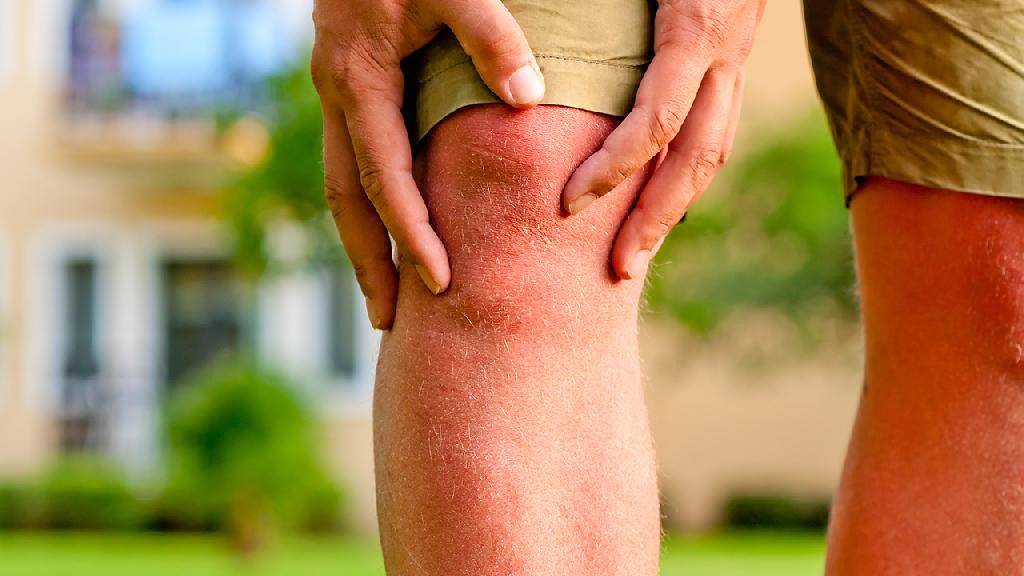 膝关节痛该如何进行治疗 膝关节痛的病因都有哪些
