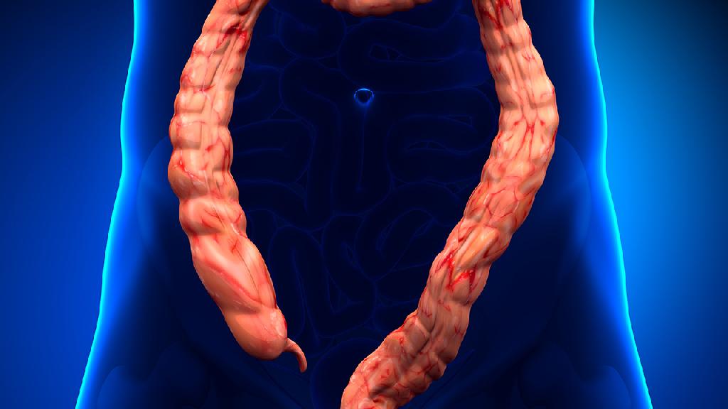 直肠息肉容易癌变吗 直肠息肉该如何进行治疗