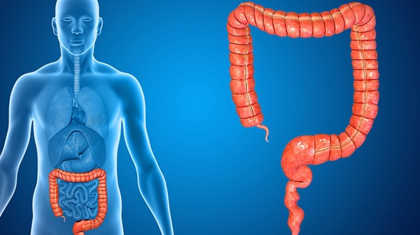导致直肠息肉的原因都有哪些 长期腹泻也会诱发直肠息肉吗