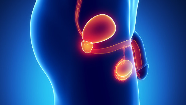 尿结石的症状 尿结石常见的表现有4种