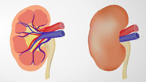 尿路结石是怎么形成的 尿路结石的4个症状表现