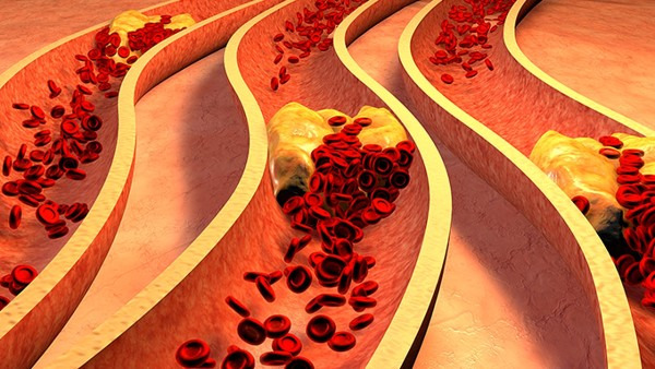 血管瘤对身体有影响吗，血管瘤对身体有哪些影响？