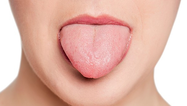 舌头烫伤立即喝凉水，口里含冰水，用盐水冲洗嘴等