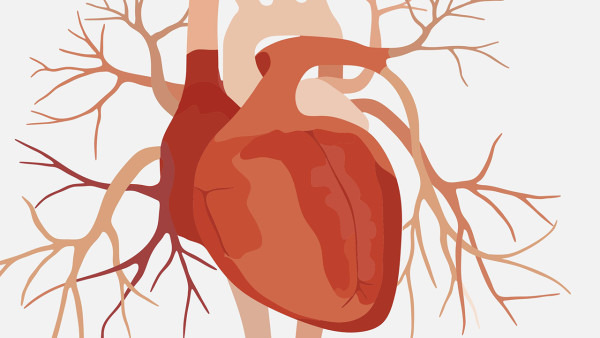 哪些先天性心脏病适合介入治疗 介入治疗适合先天性心脏病种类