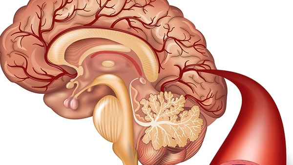 生理性脑积水是大脑表面颅内积滞大量脑脊液所致