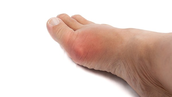 脚底脱皮是怎么回事 导致脚底蜕皮的病因都有哪些