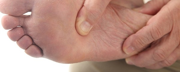糜爛型腳氣用什么藥最好 糜爛型腳氣該如何進(jìn)行護(hù)理