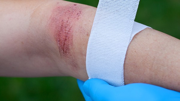 割伤怎样不留疤，割伤后需要注意什么？