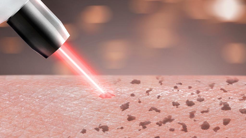 水痘留疤怎么去掉？主要有这5种方法