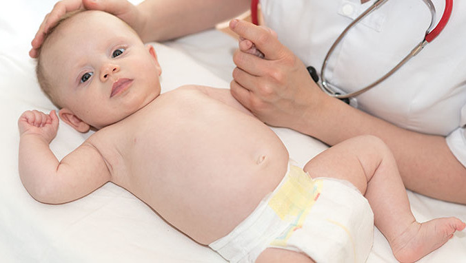 婴儿湿疹的最佳治疗方法是什么 婴儿湿疹该如何进行预防护理