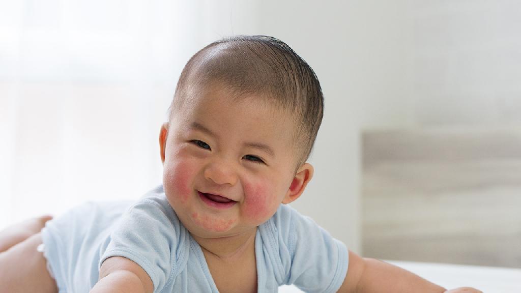 幼儿面部湿疹的症状有哪些