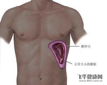 轻度脂肪肝引起的脾肿大需要治疗吗