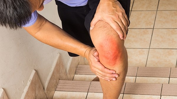 蹲下去膝盖会痛是怎么回事？可能是膝关节炎