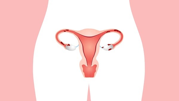 卵巢早衰应该怎样治疗，6种常用的卵巢早衰疗法