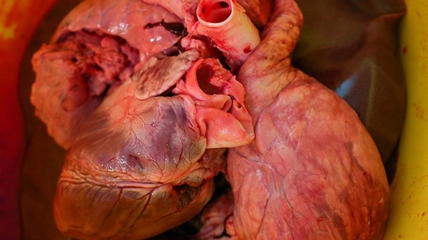心脏病人可以吃猪心吗增强心肌营养