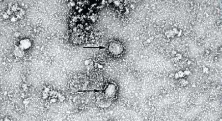 欧洲研究团队发文，称找到新冠病毒致命弱点