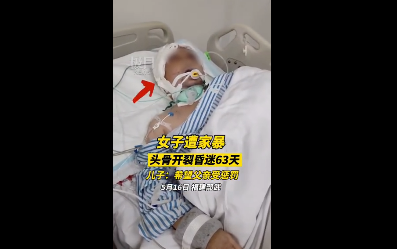 北京程序员长期家暴妻子，致其头骨开裂昏迷63天