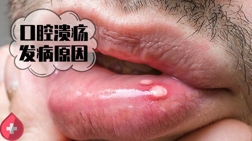 瘦身知识 喜欢也要克制 这7种食物容易导致消化不良