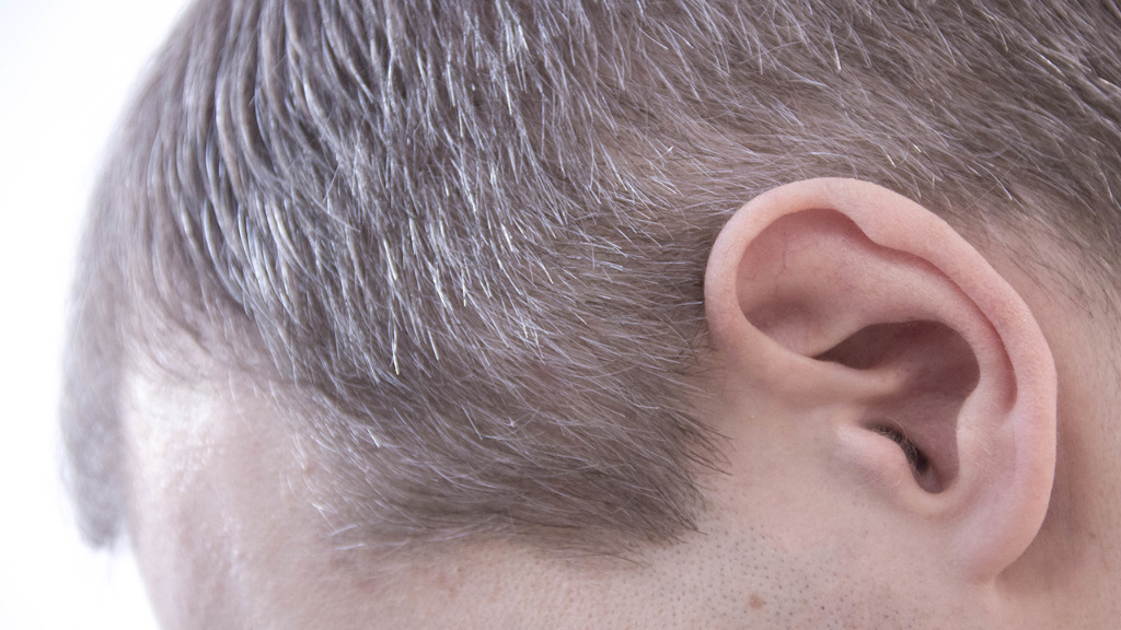 未老先衰白头发变多怎么办，治疗白头发可用5个偏方