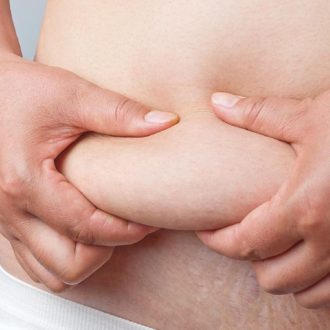 肚脐贴真的能减肥吗？