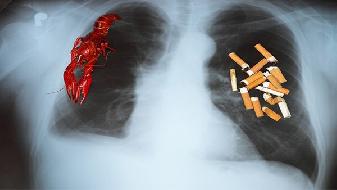 肺内脂肪瘤的危害是哪些  肺内脂肪瘤怎么办