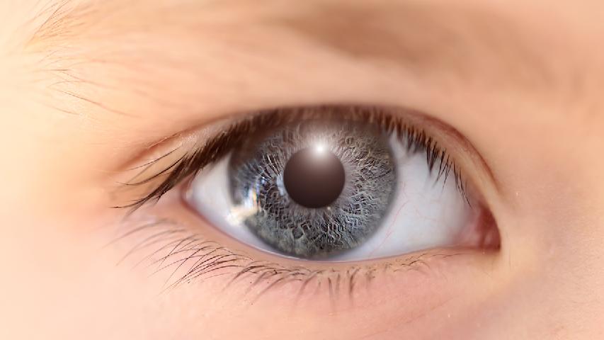 眼睛经常的发痒是怎么回事  要留心过敏性结膜炎发作