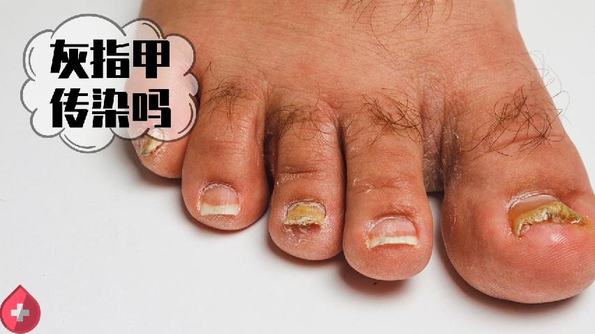 洪涝灾害灾后疾病防控知识要点