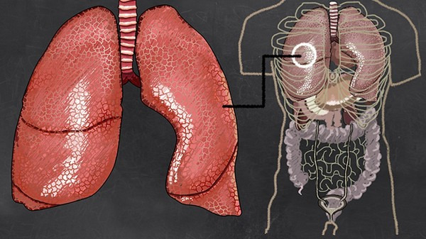 肺气肿有什么症状 常见的4个症状