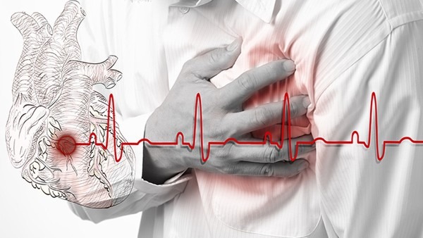 心肌梗死的早期症状有哪些 出现3种异常可能是心肌梗死早期表现